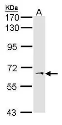 Anti-PAPSS1 antibody [C1C3] used in Western Blot (WB). GTX103608