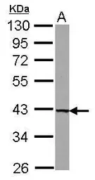 Anti-UROD antibody [N3C3] used in Western Blot (WB). GTX103610