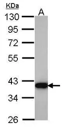 Anti-HSD3a antibody [N1C2] used in Western Blot (WB). GTX103613
