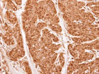 Anti-Proteasome 20S alpha 2 antibody [N1C3] used in IHC (Paraffin sections) (IHC-P). GTX103620