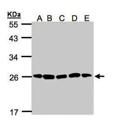 Anti-Proteasome 20S alpha 2 antibody [N1C3] used in Western Blot (WB). GTX103620