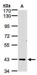 Anti-ZNF211 antibody [N3C2], Internal used in Western Blot (WB). GTX103624
