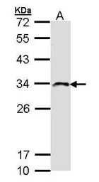 Anti-IMPA2 antibody [N1C3] used in Western Blot (WB). GTX103636