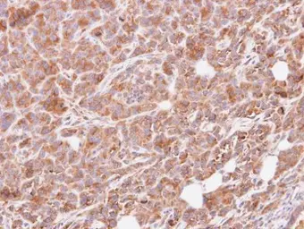 Anti-GNAI3 antibody [N2C3] used in IHC (Paraffin sections) (IHC-P). GTX103676