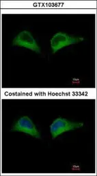 Anti-PSMD7 antibody used in Immunocytochemistry/ Immunofluorescence (ICC/IF). GTX103677