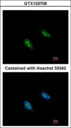 Anti-RFC3 antibody used in Immunocytochemistry/ Immunofluorescence (ICC/IF). GTX103706