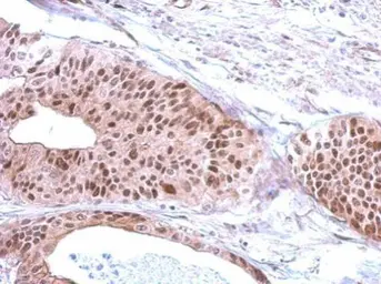 Anti-RFC3 antibody used in IHC (Paraffin sections) (IHC-P). GTX103706