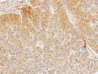 Anti-Seladin 1 antibody [N1C2] used in IHC (Paraffin sections) (IHC-P). GTX103712