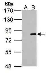 Anti-Cullin 3 antibody used in Western Blot (WB). GTX103715