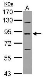 Anti-PLA2G6 antibody [N3C3] used in Western Blot (WB). GTX103717