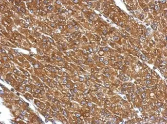 Anti-CYP27A1 antibody used in IHC (Paraffin sections) (IHC-P). GTX103718