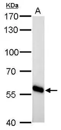 Anti-CYP27A1 antibody used in Western Blot (WB). GTX103718