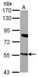Anti-CYP27A1 antibody used in Western Blot (WB). GTX103718