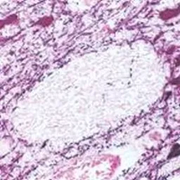 Anti-Tyrosine Hydroxylase antibody [185] used in IHC (Paraffin sections) (IHC-P). GTX10372