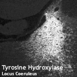 Anti-Tyrosine Hydroxylase antibody [185] used in Immunohistochemistry (IHC). GTX10372