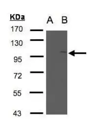 Anti-FAN antibody [N2C1], Internal used in Western Blot (WB). GTX103723