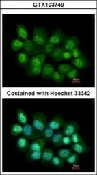 Anti-PRMT2 antibody [N1C2] used in Immunocytochemistry/ Immunofluorescence (ICC/IF). GTX103749