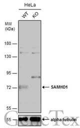 Anti-SAMHD1 antibody [N2C2], Internal used in Western Blot (WB). GTX103751