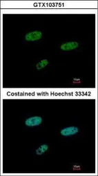 Anti-SAMHD1 antibody [N2C2], Internal used in Immunocytochemistry/ Immunofluorescence (ICC/IF). GTX103751