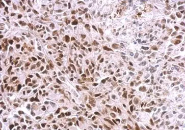 Anti-SAMHD1 antibody [N2C2], Internal used in IHC (Paraffin sections) (IHC-P). GTX103751