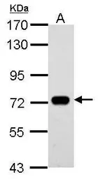 Anti-SAMHD1 antibody [N2C2], Internal used in Western Blot (WB). GTX103751