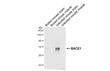 Anti-BACE1 antibody [N1C2] used in Western Blot (WB). GTX103757