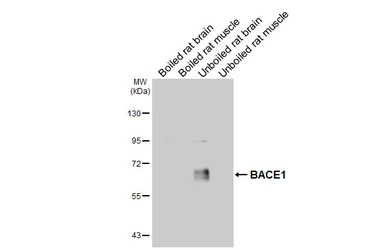 Anti-BACE1 antibody [N1C2] used in Western Blot (WB). GTX103757