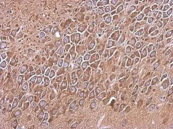 Anti-RP105 antibody [N2C2], Internal used in IHC (Paraffin sections) (IHC-P). GTX103761