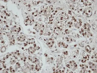 Anti-SEPHS2 antibody used in IHC (Paraffin sections) (IHC-P). GTX103766
