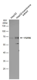 Anti-FGFR5 antibody used in Western Blot (WB). GTX103778