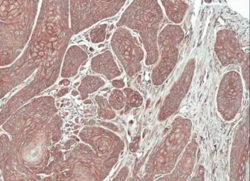 Anti-FGFR5 antibody used in IHC (Paraffin sections) (IHC-P). GTX103778