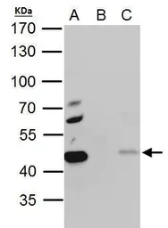Anti-EBP1 antibody used in Immunoprecipitation (IP). GTX103791