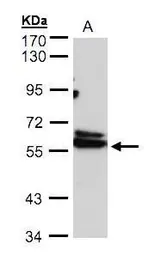 Anti-TCP1 delta antibody [N2C3] used in Western Blot (WB). GTX103795