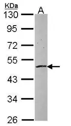 Anti-ZNF140 antibody [N1C3] used in Western Blot (WB). GTX103803