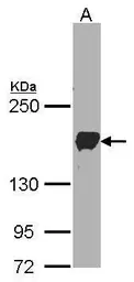 Anti-PCDH1 antibody [N1N3] used in Western Blot (WB). GTX103806