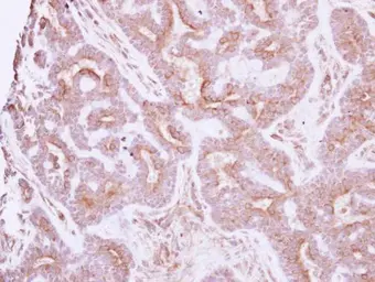 Anti-NELL1 antibody used in IHC (Paraffin sections) (IHC-P). GTX103819