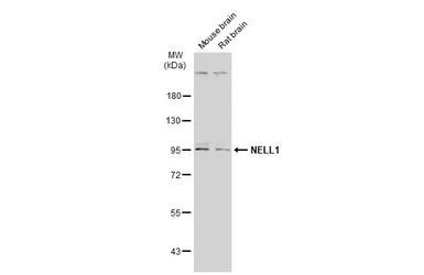 Anti-NELL1 antibody used in Western Blot (WB). GTX103819