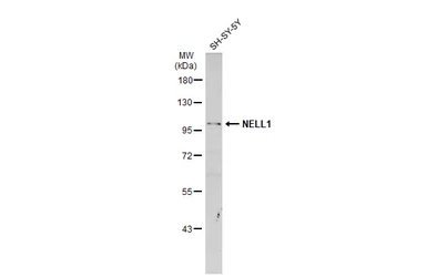 Anti-NELL1 antibody used in Western Blot (WB). GTX103819