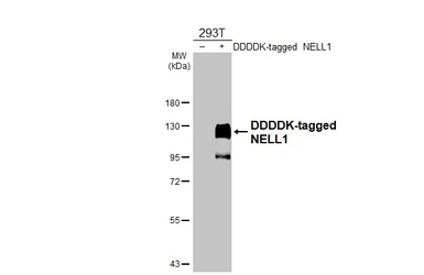 Anti-NELL1 antibody used in Western Blot (WB). GTX103819