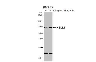 Anti-NELL1 antibody used in Western Blot (WB). GTX103819