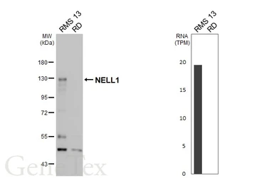 Anti-NELL1 antibody used in Western Blot (WB). GTX103819
