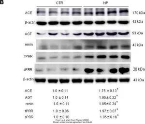 Anti-Angiotensinogen antibody [N1C3] used in Western Blot (WB). GTX103824