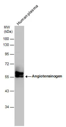 Anti-Angiotensinogen antibody [N1C3] used in Western Blot (WB). GTX103824
