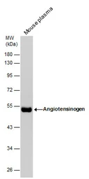 Anti-Angiotensinogen antibody [N1C3] used in Western Blot (WB). GTX103824