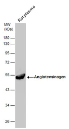 Anti-Angiotensinogen antibody [N1C3] used in Western Blot (WB). GTX103824
