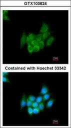 Anti-Angiotensinogen antibody [N1C3] used in Immunocytochemistry/ Immunofluorescence (ICC/IF). GTX103824
