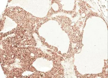 Anti-Angiotensinogen antibody [N1C3] used in IHC (Paraffin sections) (IHC-P). GTX103824