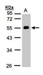 Anti-Angiotensinogen antibody [N1C3] used in Western Blot (WB). GTX103824