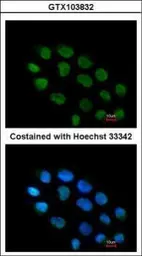 Anti-ZNF7 antibody [N1C2] used in Immunocytochemistry/ Immunofluorescence (ICC/IF). GTX103832