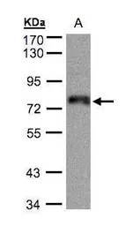 Anti-ZNF7 antibody [N1C2] used in Western Blot (WB). GTX103832